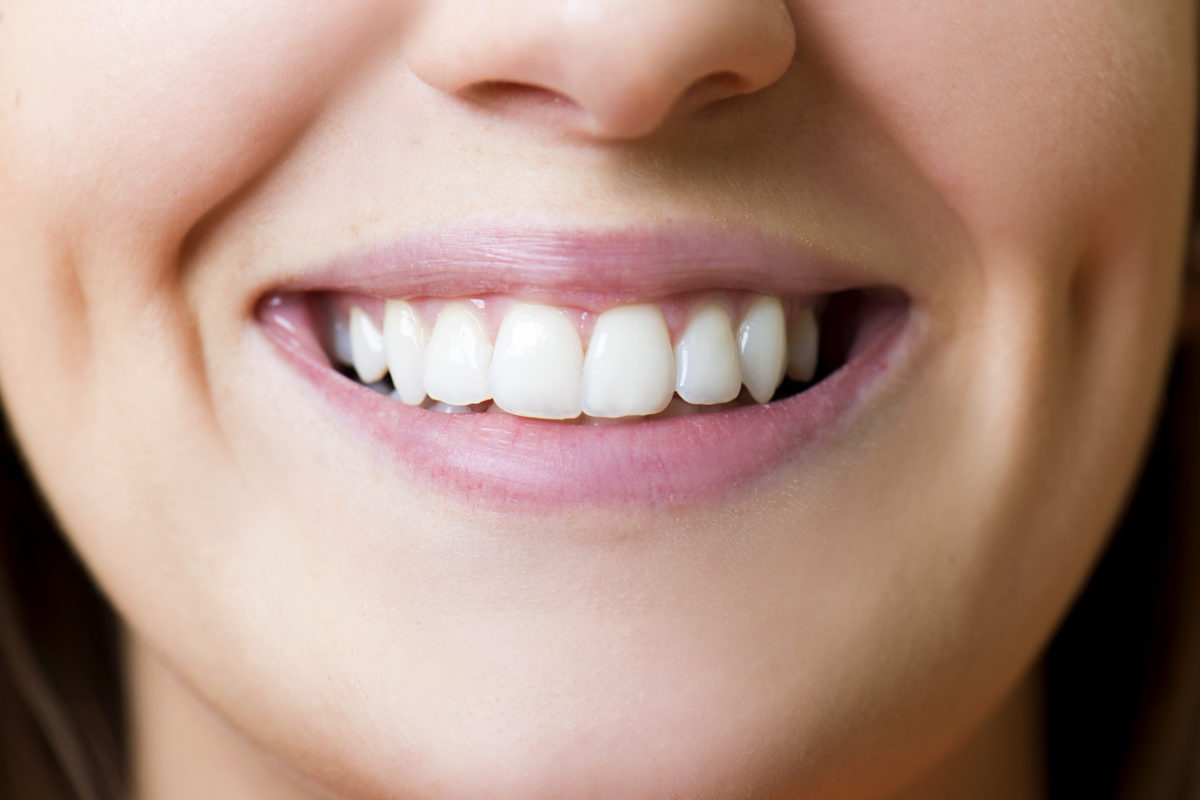 3 Benefits of Dental Sealants