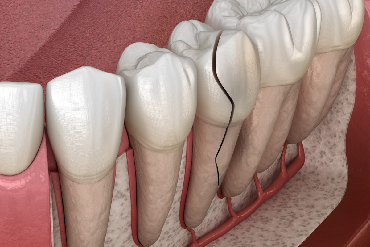 Am I Having a Dental Emergency