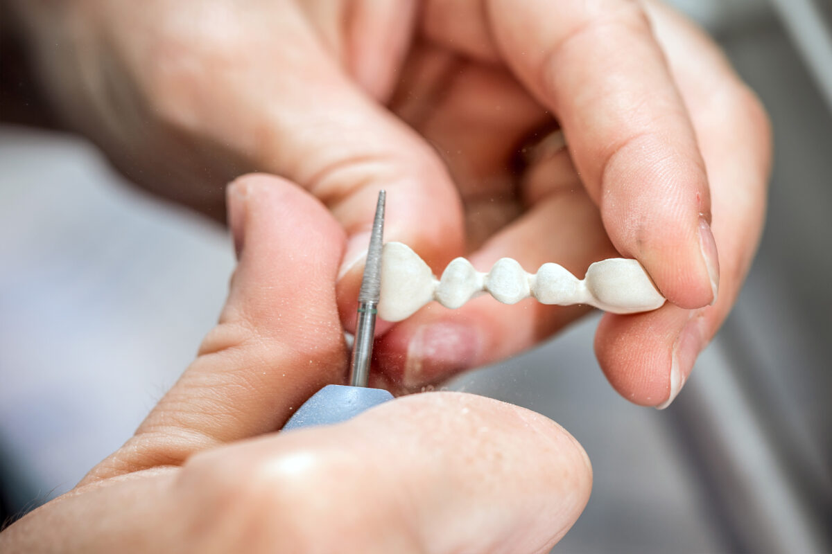 Dental Bridge Repair in Lowell, MA