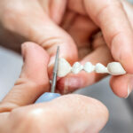 Dental Bridge Repair in Lowell, MA